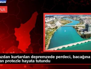 Sarsıntıda enkaz altından kurtulan perdeci protez sayesinde hayata tutundu